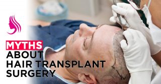 myths about hair transplant surgery