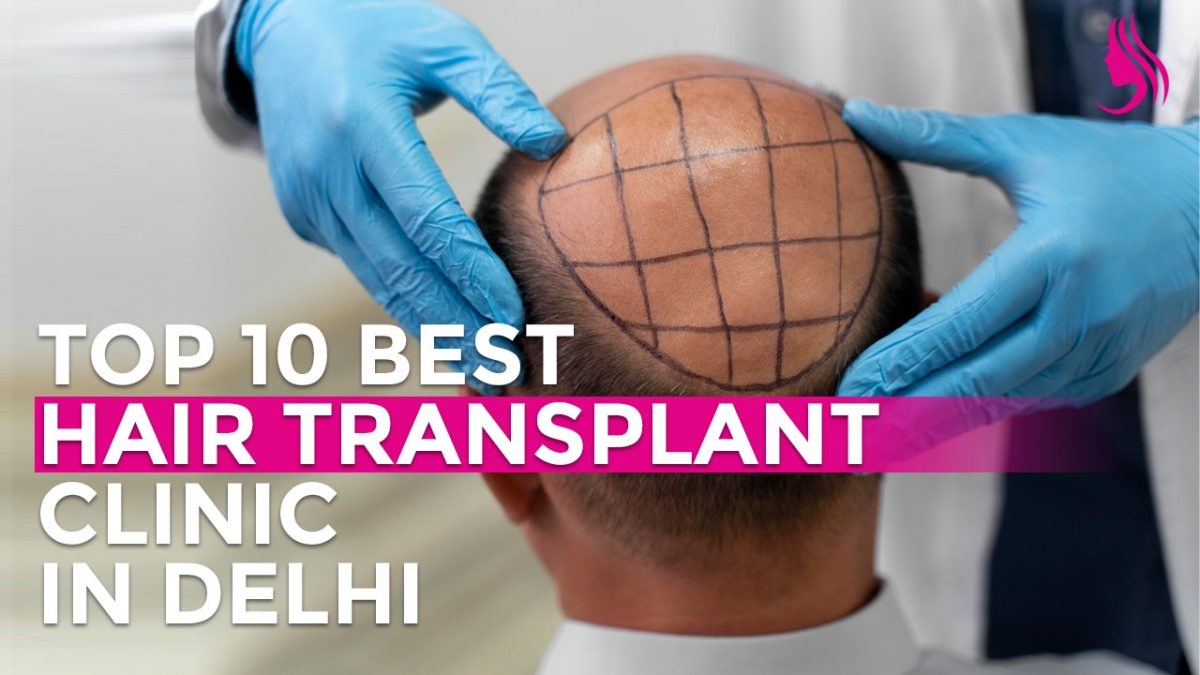 top 10 best hair transplant clinic in delhi